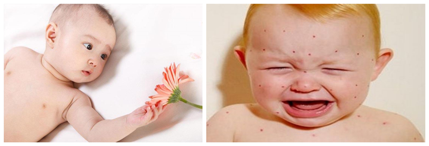 儿童湿疹反反复复，您有在家安装家用除湿产品吗？